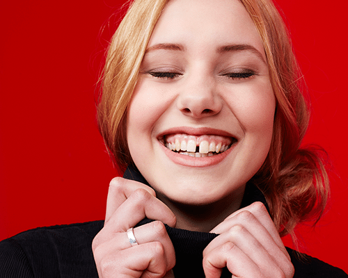 diastema como corregirlo