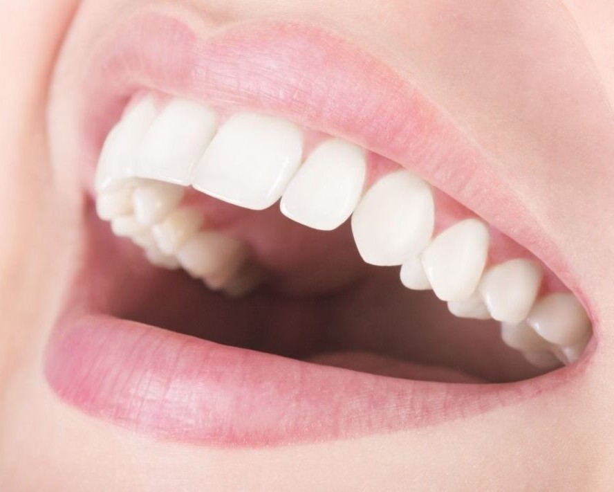 numero de dientes