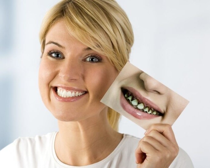 dientes podridos causas y tratamiento