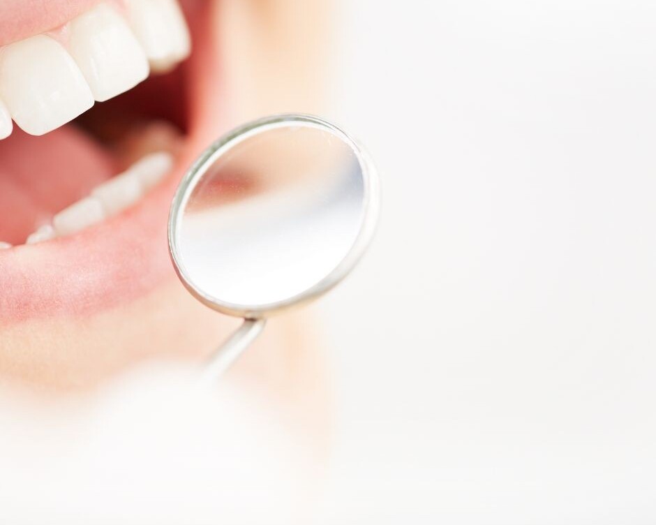 eliminar manchas dentales