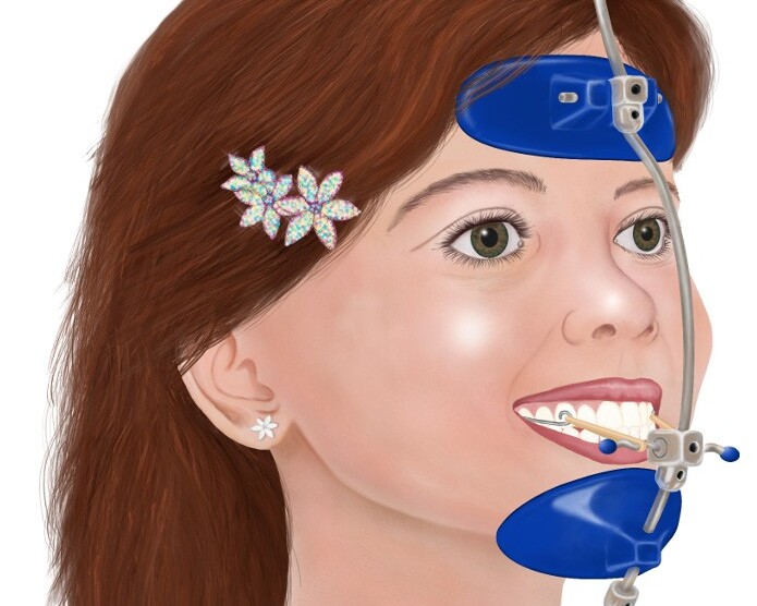 máscara facial ortodoncia